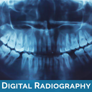 Digital Radiography in West Des Moines